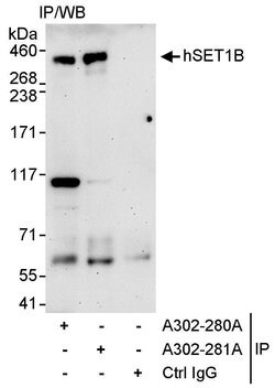 hSET1B Rabbit anti-Human, Polyclonal, Bethyl Laboratories 100 &mu;L | Buy Online | Bethyl Laboratories, Inc | Fisher Scientific