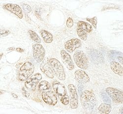 hSET1B Polyclonal Antibody, Bethyl Laboratories:Antibodies:Primary Antibodies
