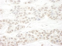 hSET1B Polyclonal Antibody, Bethyl Laboratories 10 &mu;L; Unconjugated:Antibodies,
