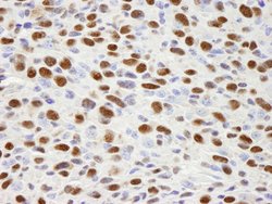 hnRNP-H Polyclonal Antibody, Bethyl Laboratories 10 &mu;L; Unconjugated:Antibodies,