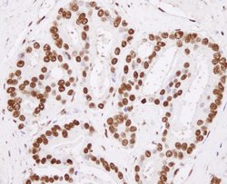 hnRNP-H Polyclonal Antibody, Bethyl Laboratories 10 &mu;L; Unconjugated:Antibodies,
