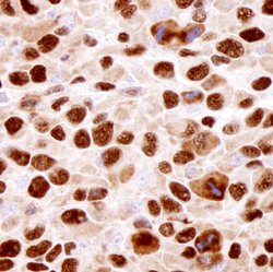 hnRNP-K Polyclonal Antibody, Bethyl Laboratories 100 &mu;L; Unconjugated:Antibodies,