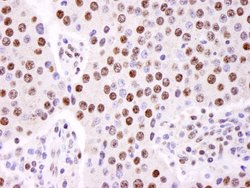 hnRNP-K Polyclonal Antibody, Bethyl Laboratories 100 &mu;L; Unconjugated:Antibodies,