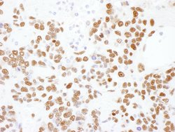 hnRNP-L Rabbit anti-Human, Mouse, Polyclonal, Bethyl Laboratories 100 &mu;l;
