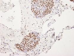 hnRNP-U Polyclonal Antibody, Bethyl Laboratories 100 &mu;L; Unconjugated:Antibodies,