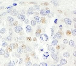 p14ARF Rabbit anti-Human, Polyclonal, Bethyl Laboratories 100 &mu;L; Unconjugated:Antibodies,