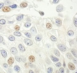 p14ARF Rabbit anti-Human, Polyclonal, Bethyl Laboratories 100 &mu;L; Unconjugated:Antibodies,