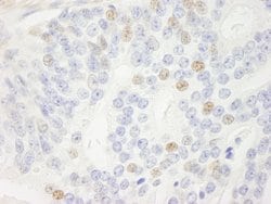 p14ARF Polyclonal Antibody, Bethyl Laboratories:Antibodies:Primary Antibodies