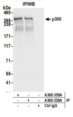 p300 Rabbit anti-Human, Polyclonal, Bethyl Laboratories 100 &mu;L; Unconjugated:Antibodies,