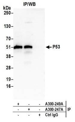 p53 Rabbit anti-Human, Polyclonal, Bethyl Laboratories 100 &mu;L; Unconjugated:Antibodies,
