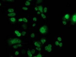 p53 Mouse anti-Human, Clone: OTI2C4, lyophilized, TrueMAB 100 &mu;g; Unconjugated:Antibodies,