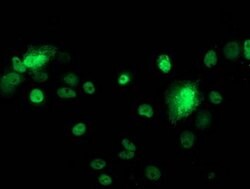 p53 Mouse anti-Human, Clone: OTI1C6, lyophilized, TrueMAB 100 &mu;g; Unconjugated:Antibodies,