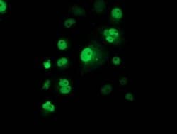p53 Monoclonal Antibody (OTI2E4), TrueMAB , OriGene:Antibodies:Primary