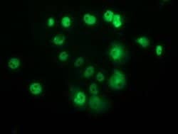 p53 Mouse anti-Human, Clone: OTI2F7, lyophilized, TrueMAB 100 &mu;g; Unconjugated:Antibodies,