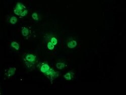 p53 Monoclonal Antibody (OTI1D8), TrueMAB , OriGene 100 &mu;L; Unconjugated:Antibodies,