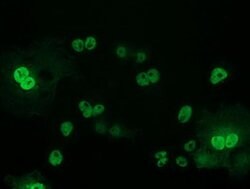 p53 Monoclonal Antibody (OTI5B2), TrueMAB , OriGene:Antibodies:Primary