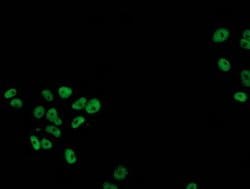 p53 Mouse anti-Human, Clone: OTI3A6, lyophilized, TrueMAB 100 &mu;g; Unconjugated:Antibodies,