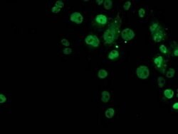 p53 Monoclonal Antibody (OTI2H4), TrueMAB , OriGene 100 &mu;L; Unconjugated:Antibodies,
