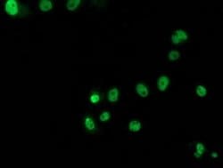 p53 Monoclonal Antibody (OTI5D9), TrueMAB , OriGene 30 &mu;L; Unconjugated:Antibodies,