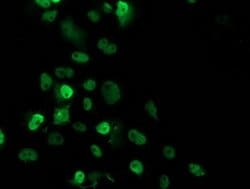 p53 Monoclonal Antibody (OTI1D11), TrueMAB , OriGene 30 &mu;L; Unconjugated:Antibodies,