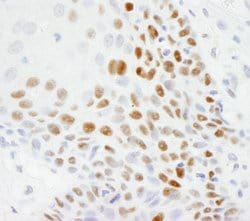 p53 Polyclonal Antibody, Bethyl Laboratories 100 &mu;L; Unconjugated:Antibodies,