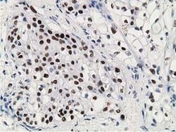 p53 Monoclonal Antibody (OTI3D5), TrueMAB , OriGene 100 &mu;L; Unconjugated:Antibodies,