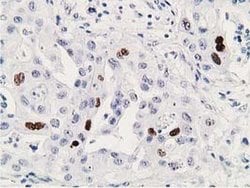 p53 Monoclonal Antibody (OTI3D5), TrueMAB , OriGene 100 &mu;L; Unconjugated:Antibodies,