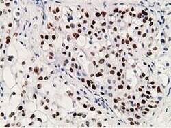 p53 Mouse anti-Human, Clone: OTI2C4, lyophilized, TrueMAB 100 &mu;g; Unconjugated:Antibodies,