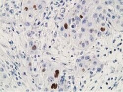 p53 Mouse anti-Human, Clone: OTI2C4, lyophilized, TrueMAB 100 &mu;g; Unconjugated:Antibodies,