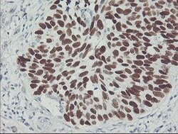 p53 Mouse anti-Human, Clone: OTI1C6, lyophilized, TrueMAB 100 &mu;g; Unconjugated:Antibodies,