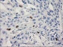 p53 Monoclonal Antibody (OTI3G9), TrueMAB , OriGene:Antibodies:Primary