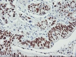p53 Mouse anti-Human, Clone: OTI2F7, lyophilized, TrueMAB 100 &mu;g; Unconjugated:Antibodies,