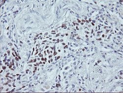 p53 Monoclonal Antibody (OTI1F4), TrueMAB , OriGene 100 &mu;L; Unconjugated:Antibodies,