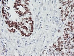 p53 Monoclonal Antibody (OTI1D8), TrueMAB , OriGene 100 &mu;L; Unconjugated:Antibodies,