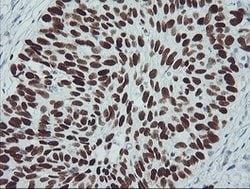 p53 Mouse anti-Human, Clone: OTI3A6, lyophilized, TrueMAB 100 &mu;g; Unconjugated:Antibodies,