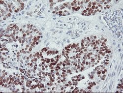 p53 Mouse anti-Human, Clone: OTI3A6, lyophilized, TrueMAB 100 &mu;g; Unconjugated:Antibodies,