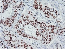 p53 Mouse anti-Human, Clone: OTI3A6, lyophilized, TrueMAB 100 &mu;g; Unconjugated:Antibodies,