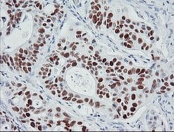 p53 Monoclonal Antibody (OTI3A6), TrueMAB , OriGene:Antibodies:Primary