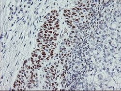 p53 Mouse anti-Human, Clone: OTI3A6, lyophilized, TrueMAB 100 &mu;g; Unconjugated:Antibodies,