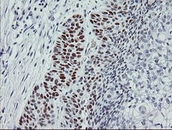 p53 Monoclonal Antibody (OTI3A6), TrueMAB , OriGene 100 &mu;L; Unconjugated:Antibodies,