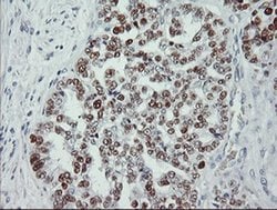 p53 Monoclonal Antibody (OTI1D11), TrueMAB , OriGene 30 &mu;L; Unconjugated:Antibodies,
