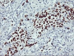 p53 Mouse anti-Human, Clone: OTI1E1, lyophilized, TrueMAB 100 &mu;g; Unconjugated:Antibodies,