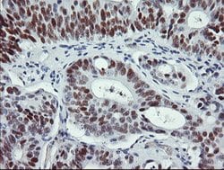 p53 Mouse anti-Human, Clone: OTI1E1, lyophilized, TrueMAB 100 &mu;g; Unconjugated:Antibodies,