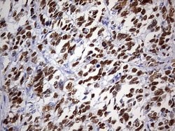p53 Monoclonal Antibody (OTI9A7), TrueMAB , OriGene 100 &mu;L; Unconjugated:Antibodies,