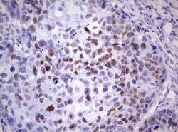 p53 Mouse anti-Human, Clone: OTI7A11, lyophilized, TrueMAB 100 &mu;g; Unconjugated:Antibodies,