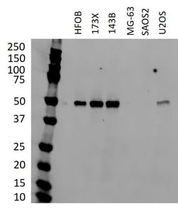 Invitrogen p53 Monoclonal Antibody (DO-7) 500 &mu;L; Unconjugated:Antibodies,