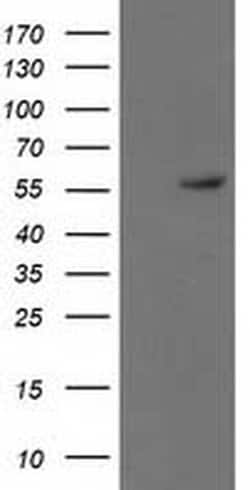 p53 Monoclonal Antibody (OTI3D5), TrueMAB , OriGene 100 &mu;L; Unconjugated:Antibodies,