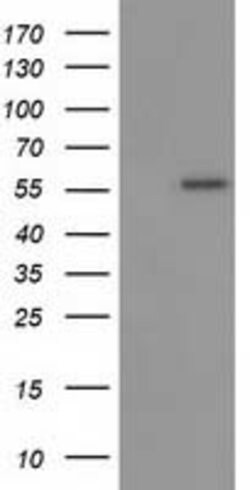 p53 Mouse anti-Human, Clone: OTI2C4, lyophilized, TrueMAB 100 &mu;g; Unconjugated:Antibodies,