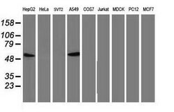 p53 Mouse anti-Human, Clone: OTI2C4, lyophilized, TrueMAB 100 &mu;g; Unconjugated:Antibodies,