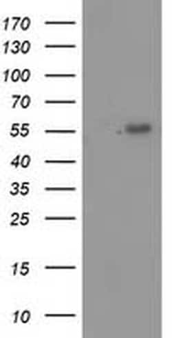 p53 Monoclonal Antibody (OTI1C6), TrueMAB , OriGene 30 &mu;L; Unconjugated:Antibodies,